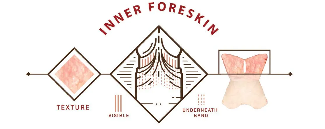 The Inner Foreskin